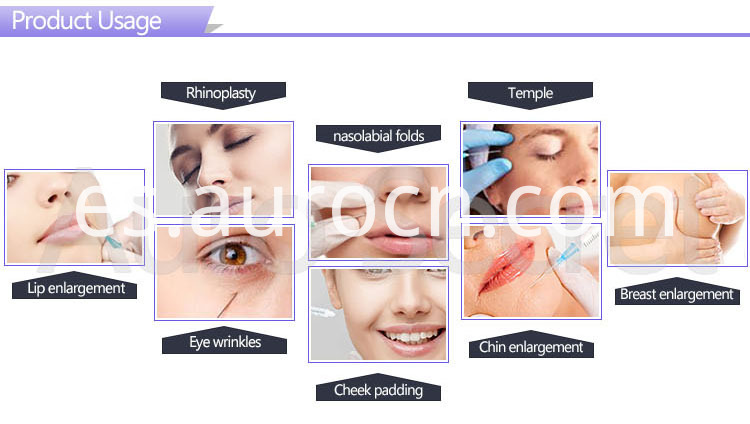 inyección intraarticular de ácido hialurónico hyaluronic acid intra-articular injection